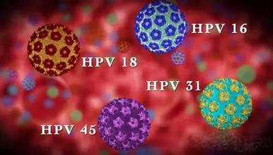 导致宫颈癌的hpv是如何感染的,容易导致宫颈癌的hpv哪几型