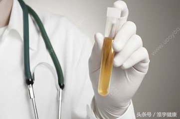 体检报告怎么看轻松看懂体检报告,2分钟看懂体检