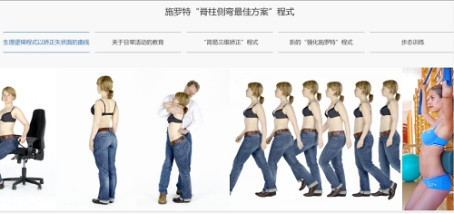 康睿仕脊柱侧弯矫正,康睿仕治疗脊柱侧弯吗