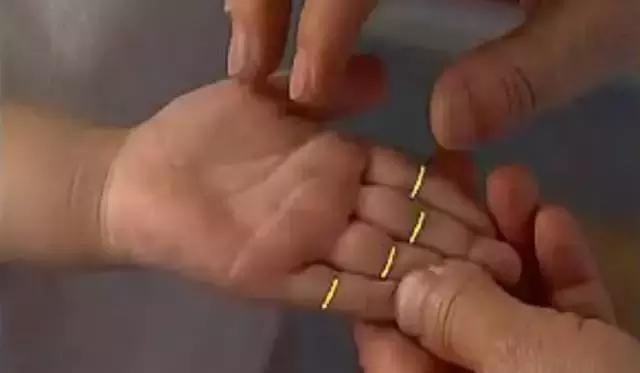 孩子湿疹怕用药有激素,不妨试试这几个穴位