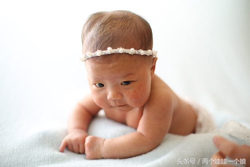 新生儿头皮血肿要不要做ct,新生儿脑出血医生说不需要处理