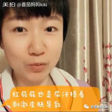 婴儿淹脖子发红怎么处理,宝宝淹脖子和红屁屁用什么产品