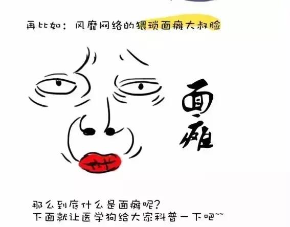 面瘫这个病是什么原因引起的,面瘫病是什么