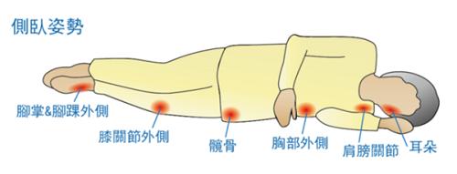 长期卧床怎么会有皮疹,长期卧床患者出现皮肤溃烂