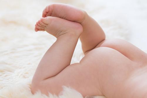 新生儿屁屁上起了很多湿疹怎么办,宝宝红屁屁并伴有湿疹怎么办