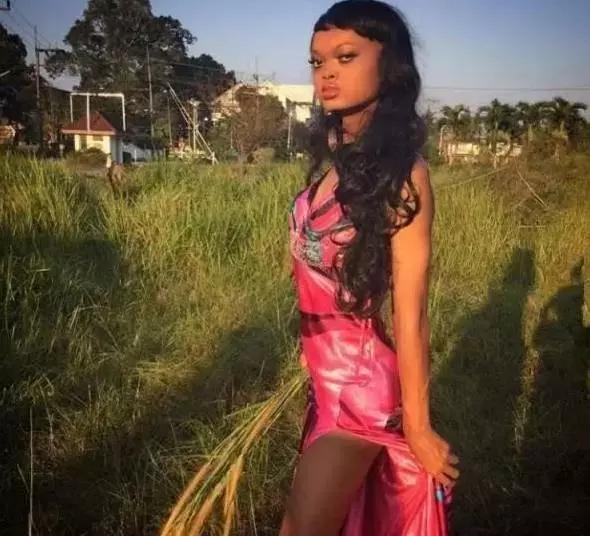 长得丑整容蜕变,长得特别丑整容成功