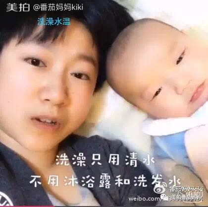 婴儿湿疹头垢洗了之后一直在出水,新生儿头垢和湿疹结痂的区别