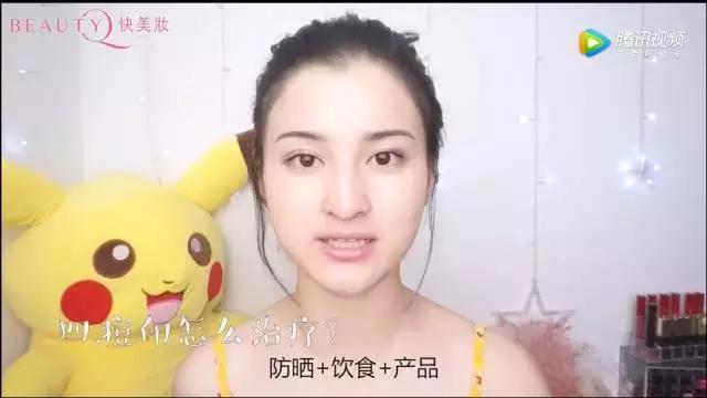 脸上的痘痘痘印怎么最有效的去除,脸上痘痘痘印多怎么治最有效最快