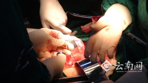 云南瑞奇德医院宜良院区,mdt多学科联合会诊系统是什么