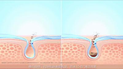 想去黑头要买什么,去黑头最好的护肤方法