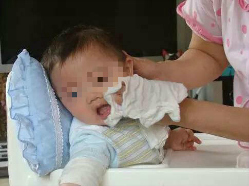 小孩身上长大黑痣什么原因,妈妈这样做导致孩子有胎记