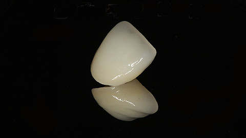 义齿知识普及,劣质义齿对身体有哪些害处