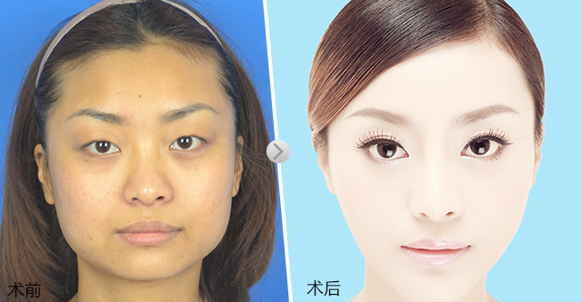 你眼里的丑也许是别人眼里的美,为什么别人很美而自己很丑