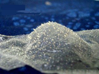 黑头怎么去小妙招,黑头怎么去最有效