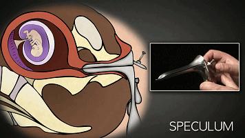 LAN《性、安全、录像带》