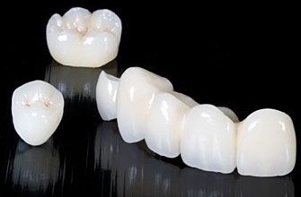 义齿知识普及,劣质义齿对身体有哪些害处