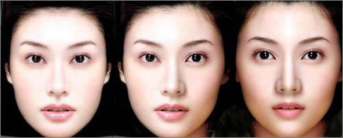 脸不对称怎么破,脸一大一小怎么矫正不对称