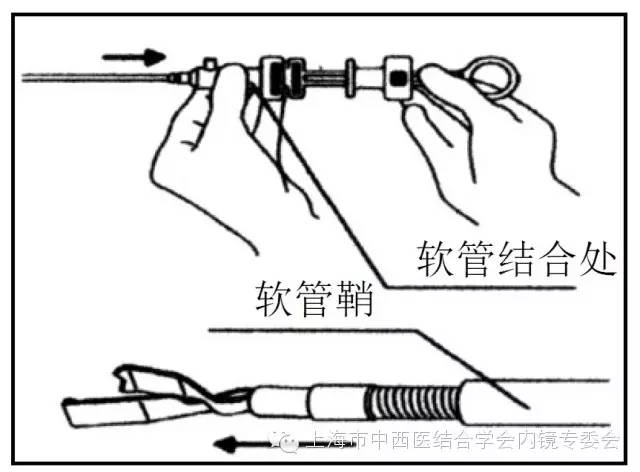 消化内镜护理配合教学视频,消化内镜取样钳