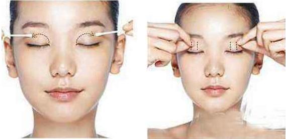 眼窝凹陷眼睛不舒服怎么办,眼窝凹陷要怎么才能好看