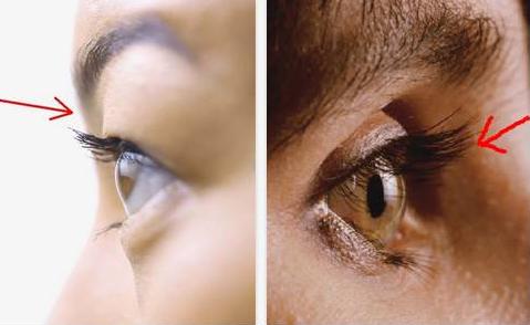 眼窝凹陷要怎么才能好看,眼睛一到下午上眼窝凹陷咋回事