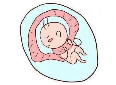胎儿脐带绕颈一周u型压迹怎么办,40周胎儿脐带绕颈二圈如何解决