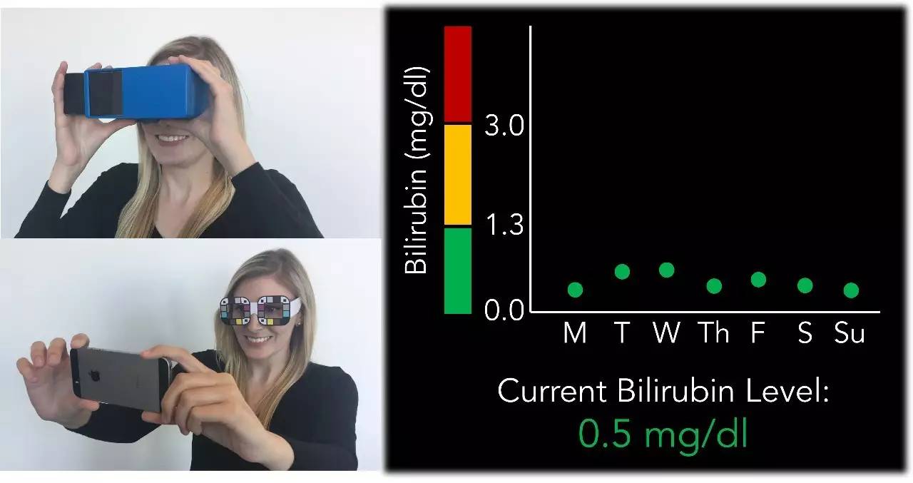 新款智能手机APP：用自拍筛查胰腺癌！