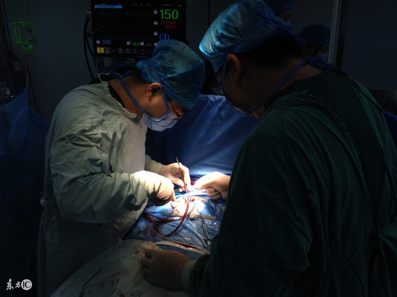 顺产可以做会阴修复吗,顺产侧切怎么睡姿有助于骨盆恢复