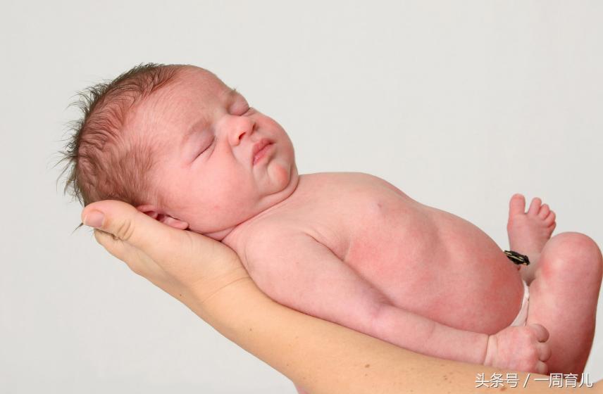 小猫崽得了泪囊炎怎么办,我得了慢性泪囊炎如何治疗