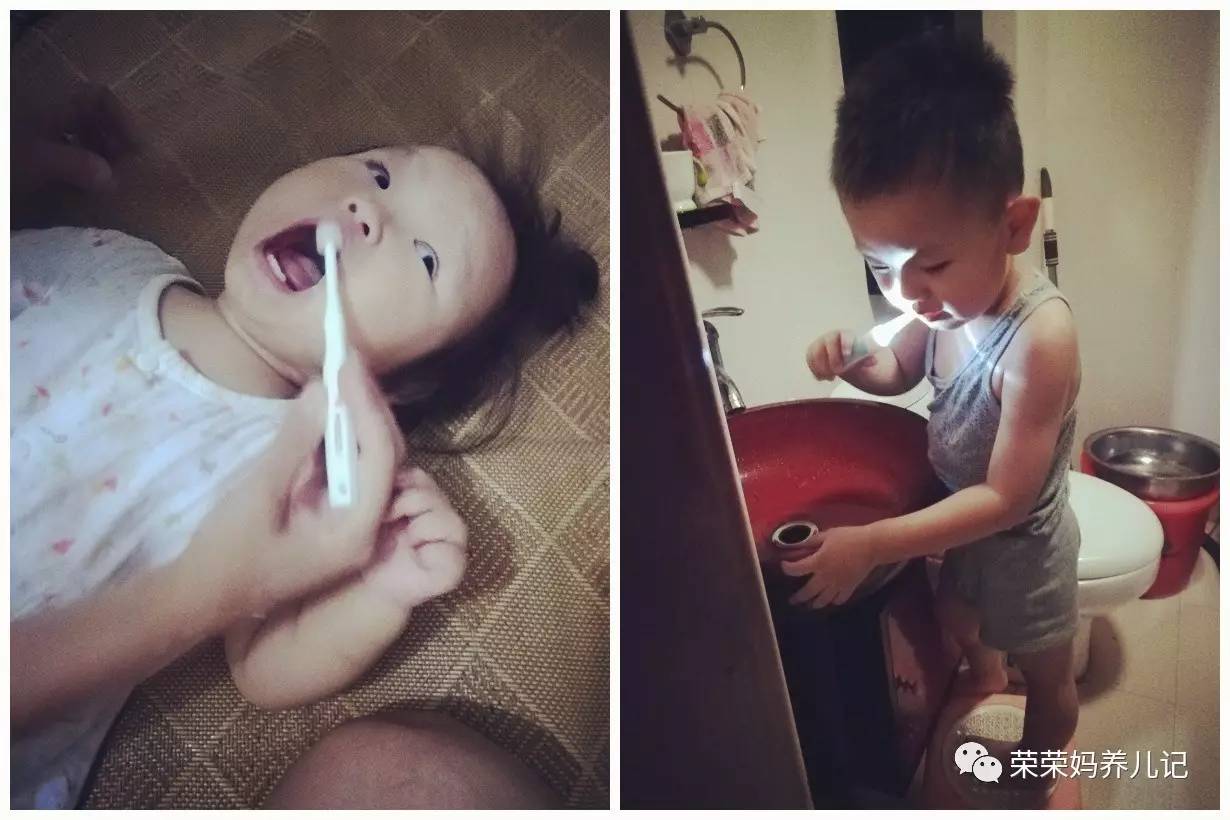 儿童涂氟前需要做口腔内窥镜吗,小孩牙齿涂氟好还是做窝沟封闭好