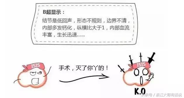 甲状腺结节是什么病,甲状腺结节是什么