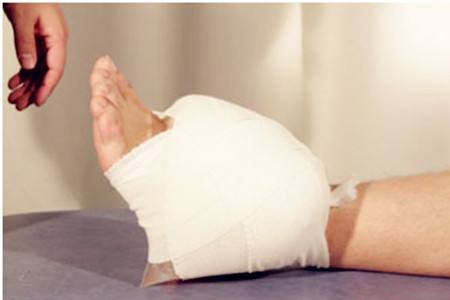 生活中崴脚紧急处理,突发情况崴到脚应该怎么处理