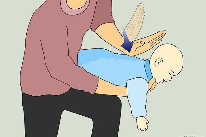 小孩误吞食物卡住喉咙急救,小孩吃东西卡住了海姆立克急救法