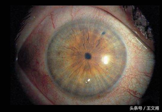 摆脱色粉,摆脱斑点和暗黄