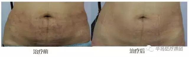 准妈妈要知道的孕期知识,准妈妈孕期常识科普节目