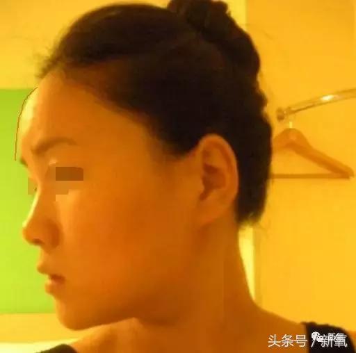 杨紫微整前后容颜对比,杨紫瘦了吗