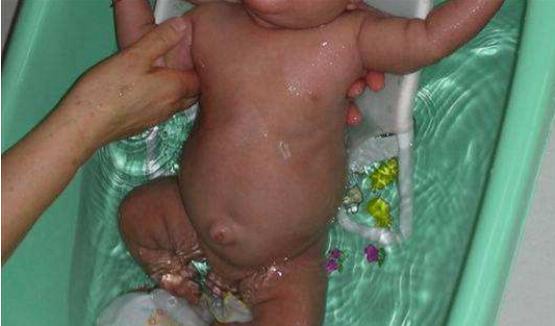 宝宝肚脐眼鼓用硬币怎么弄,看宝宝有没有肠胀气