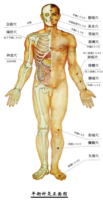 平衡针治疗腰疼的穴位,平衡针治疗失眠穴位图
