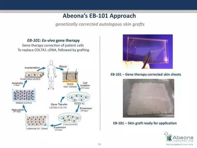 资讯癫痫创新疗法xcopri获fda批准,基因治疗皮肤病的最新进展