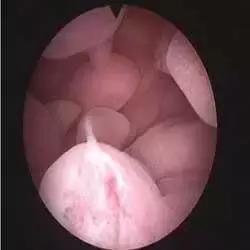 多年不孕的因果,多年不孕不育竟是妻子惹的祸