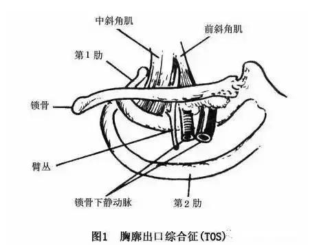 睡觉醒来手麻是什么原因和征兆,手麻的原因分析及简单评估