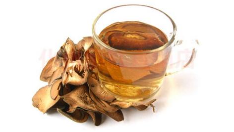 风热咳嗽临床表现,风热咳嗽应该怎么治理