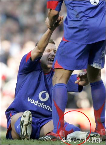 足球场上令人毛骨悚然的受伤场面,足球受伤恐怖瞬间剪辑