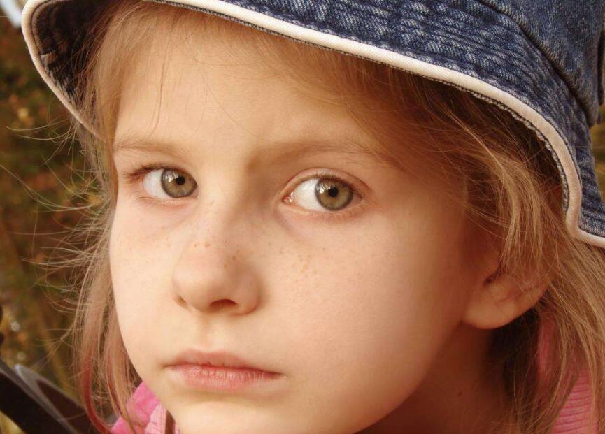 鼻梁色素沉着黑斑怎么祛除,眼镜压过鼻梁黑色素沉积