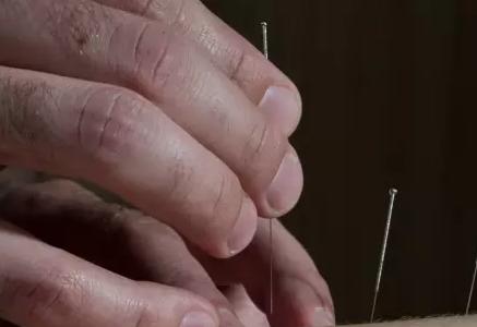 膝关节炎的针灸治疗的穴位,艾灸针灸对膝关节炎有效吗