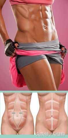 腹直肌及腹直肌分离,腹直肌脐部分离