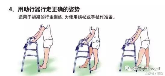 髋关节置换术后康复护理app,髋关节置换后护理康复训练视频