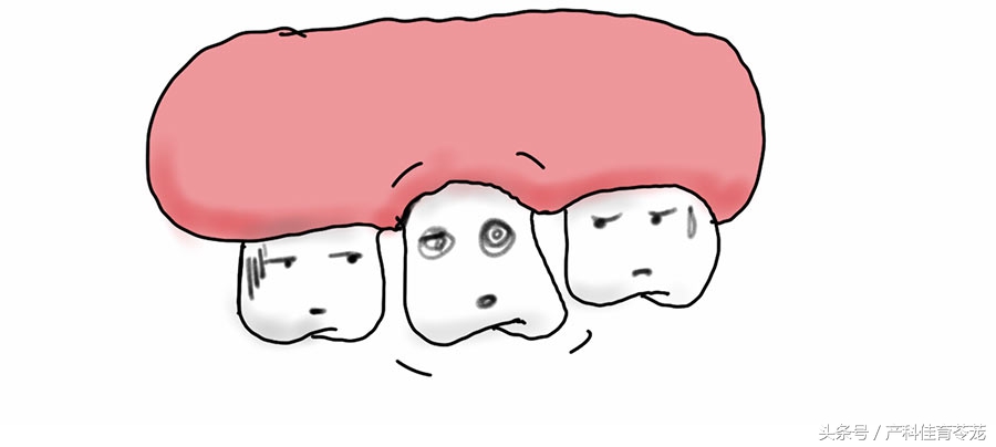 孕期检查口腔,孕期检查你到第几关了