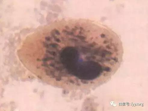 猪寄生虫最佳防治方法,猪寄生虫怎么鉴别图片