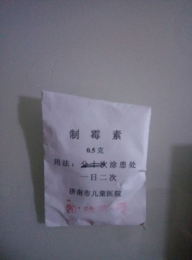 宝宝鹅口疮怎么治,宝宝得鹅口疮怎么办