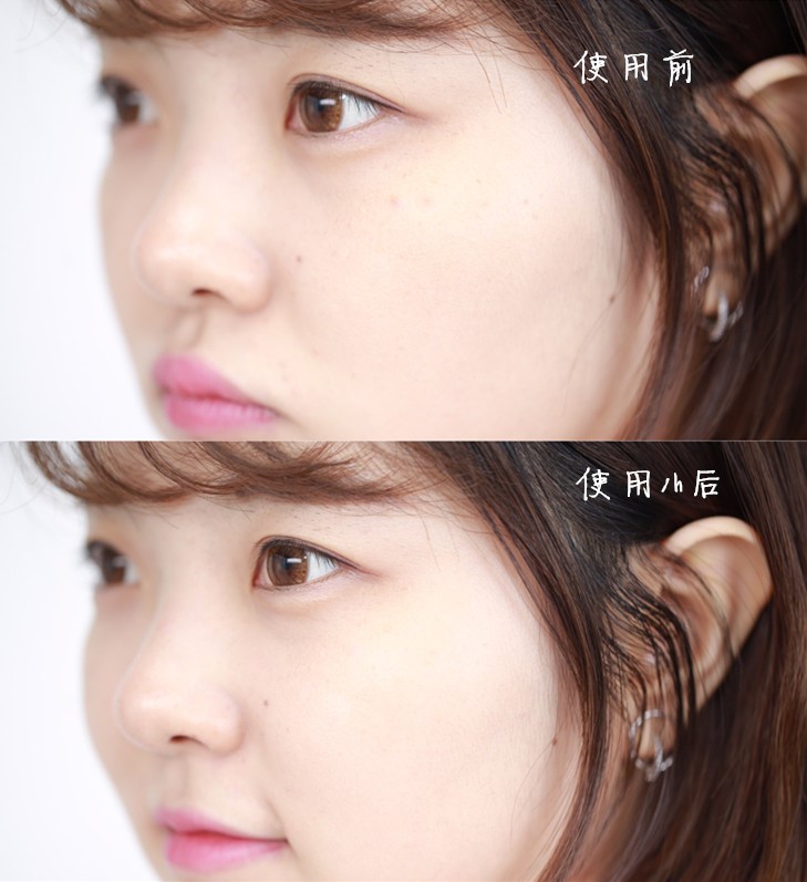 薇诺娜舒敏保湿特护cp真实测评,薇诺娜舒敏保湿修复霜适合油皮吗